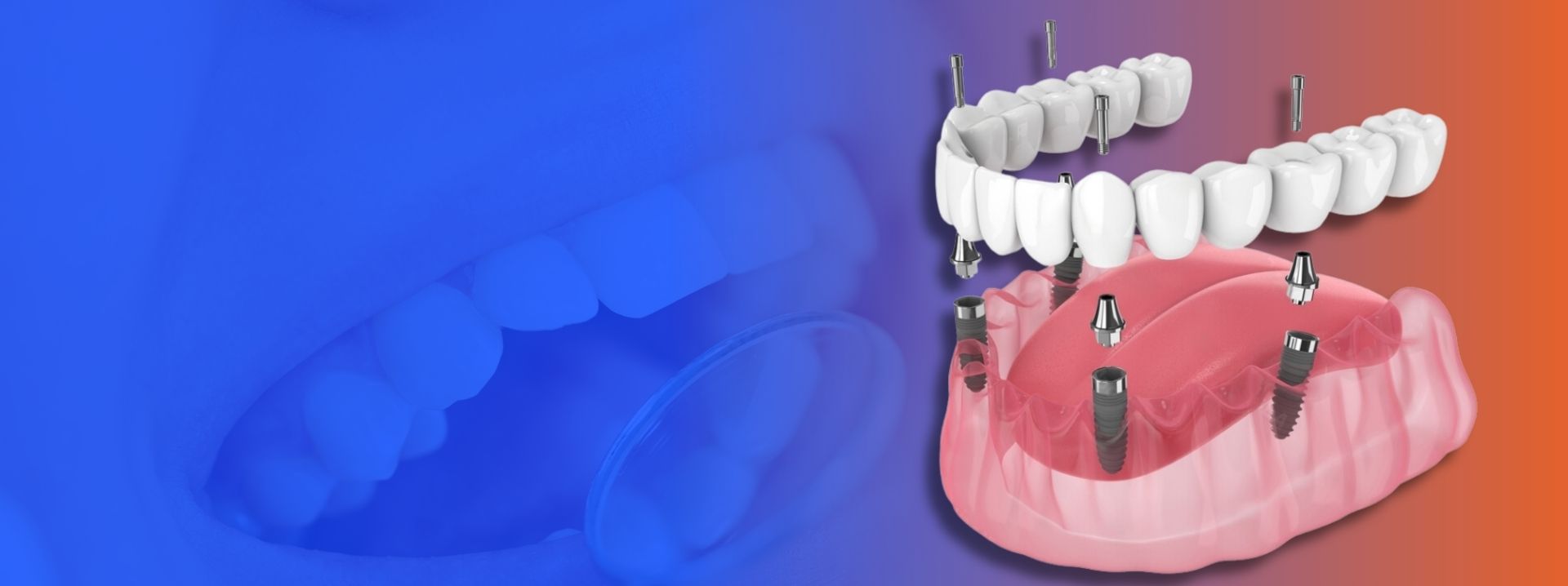 qdental
