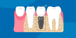qdental