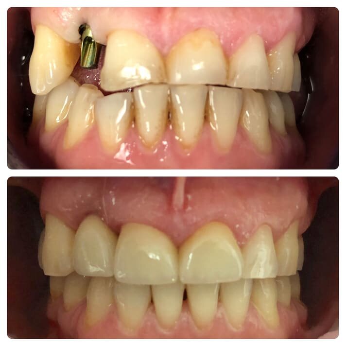 qdental