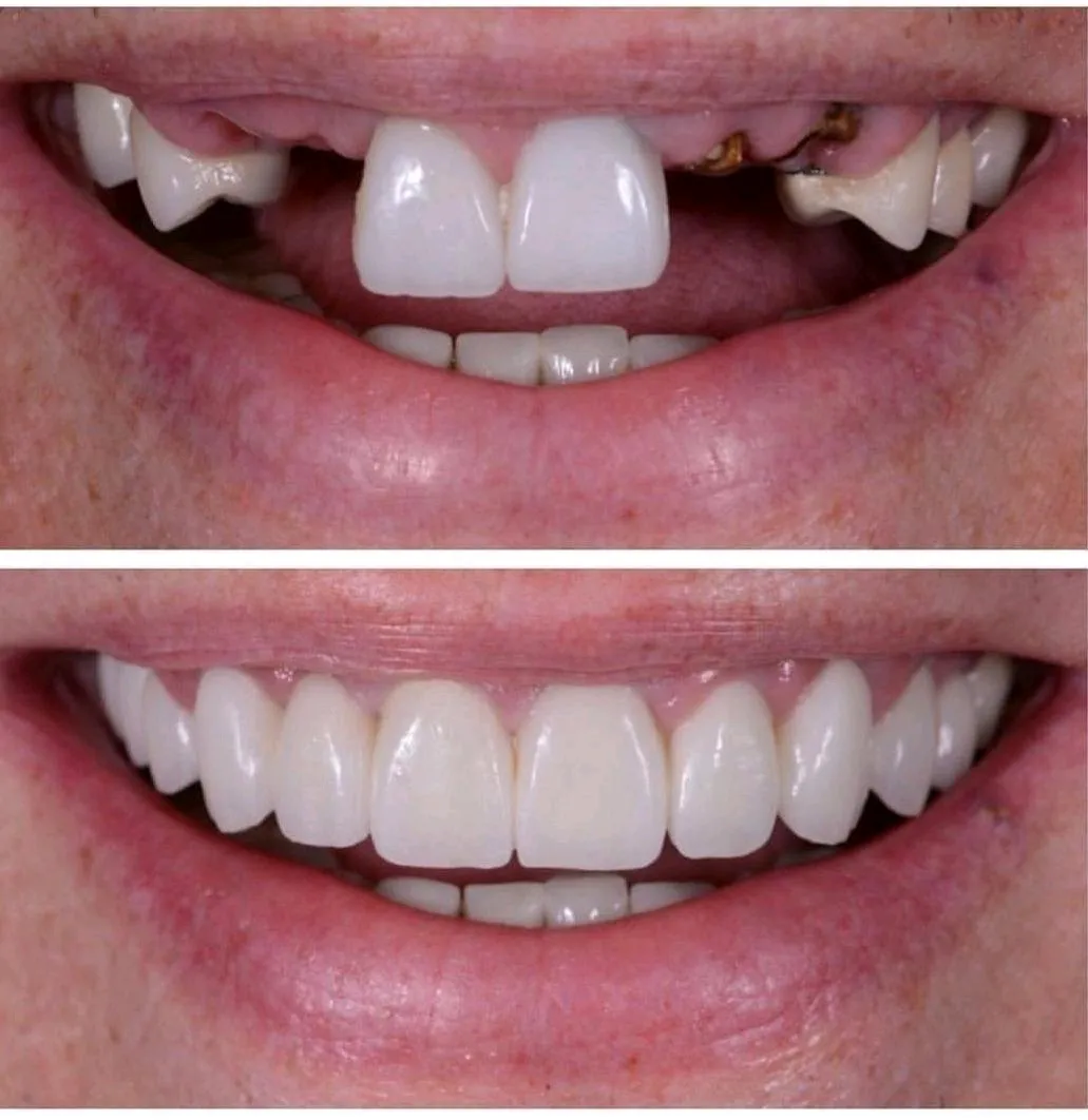 qdental