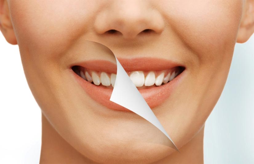 Cosmetic Dentistry