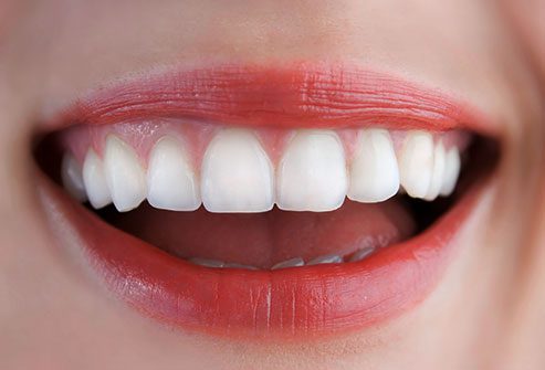 Dental Feilling