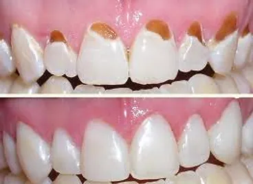 qdental