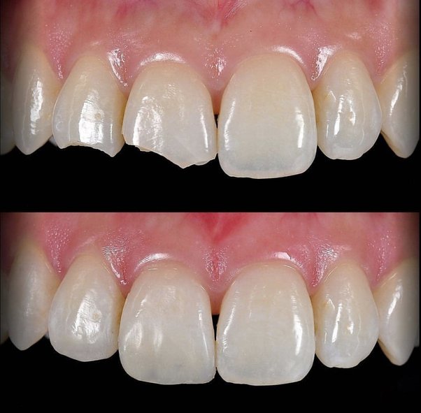 qdental