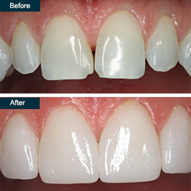 qdental