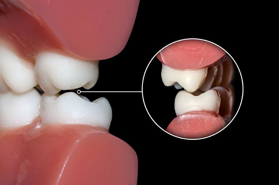 qdental