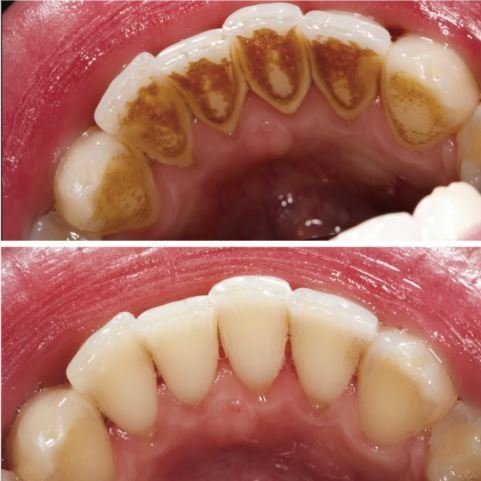 qdental