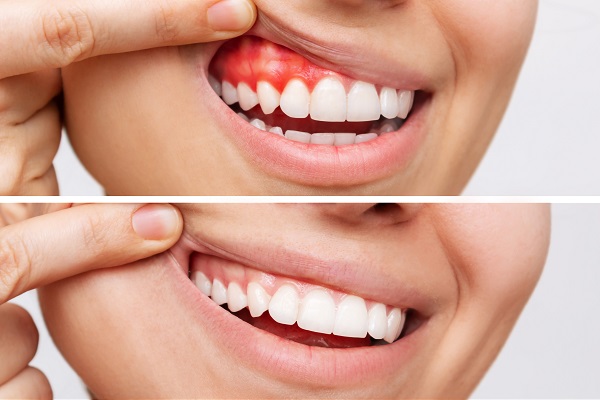 qdental