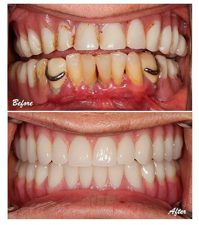 qdental