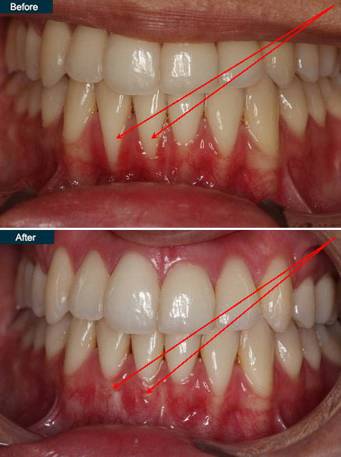 qdental