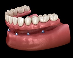 qdental