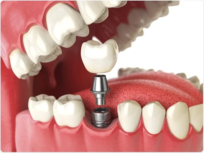 qdental