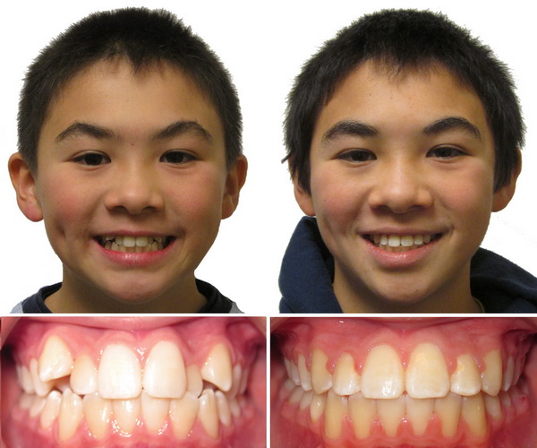 qdental