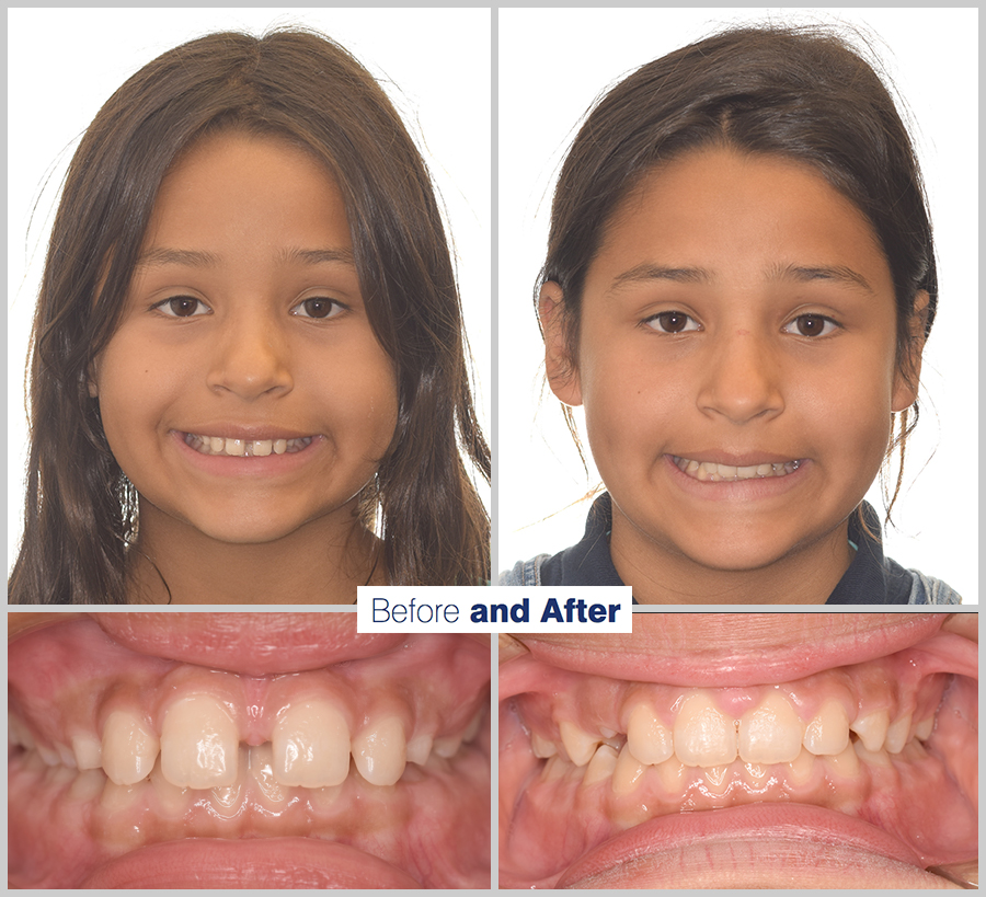 qdental