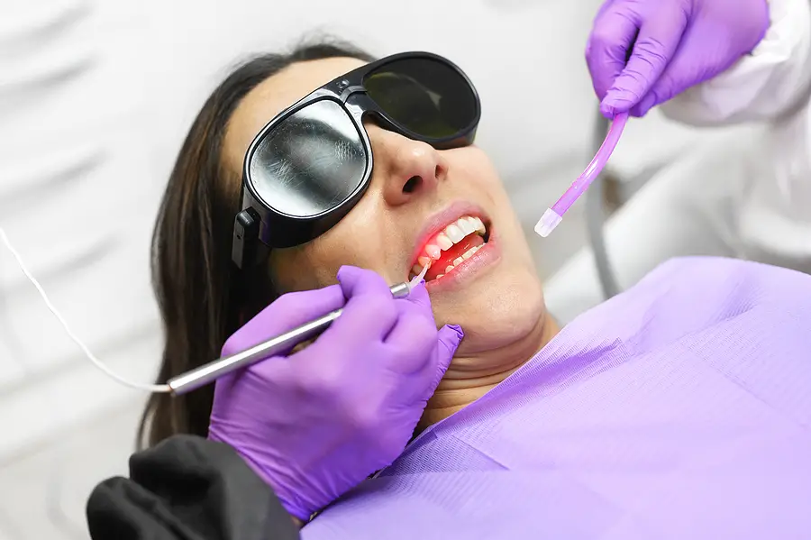  Laser Treatment for Gum Depigmentation 