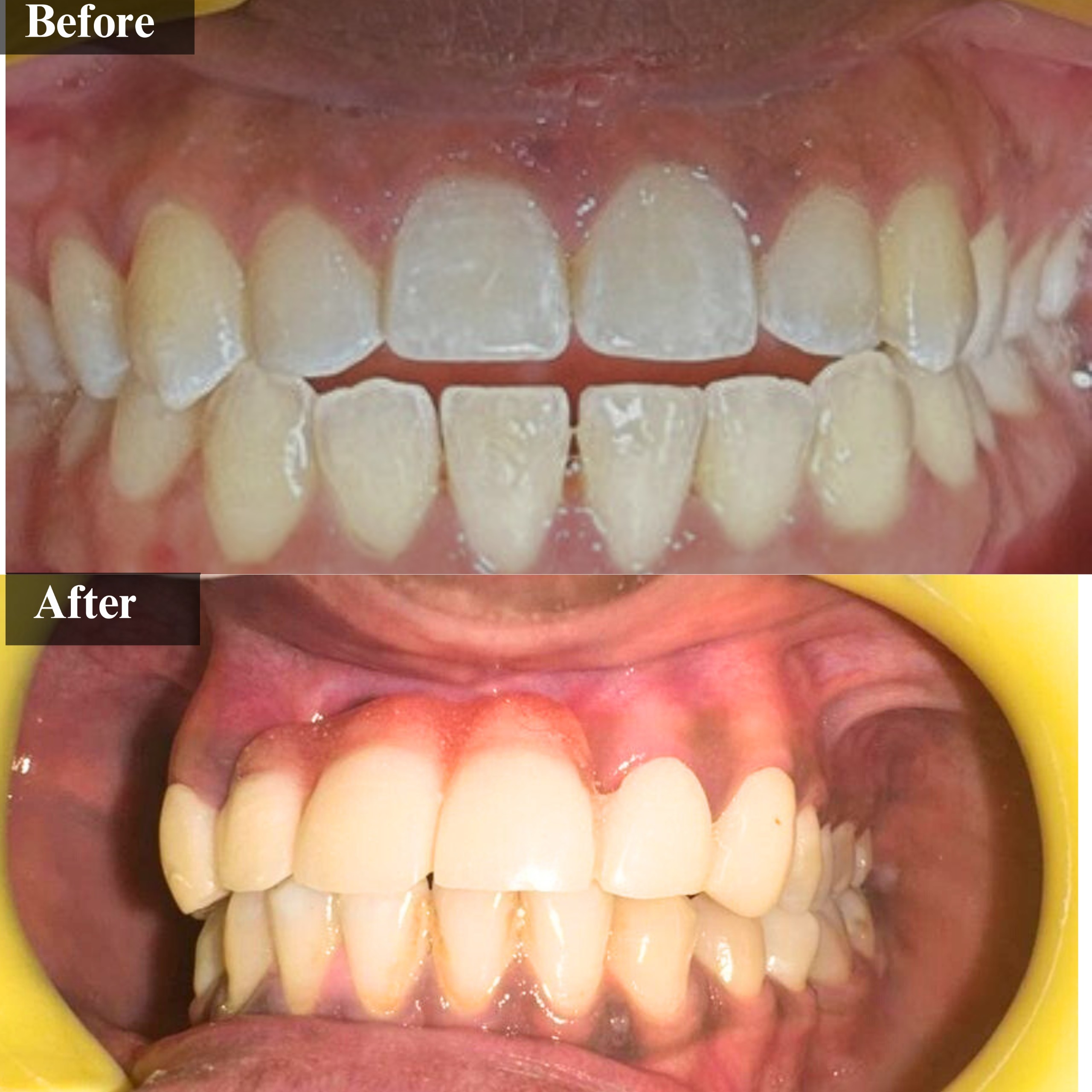 qdental