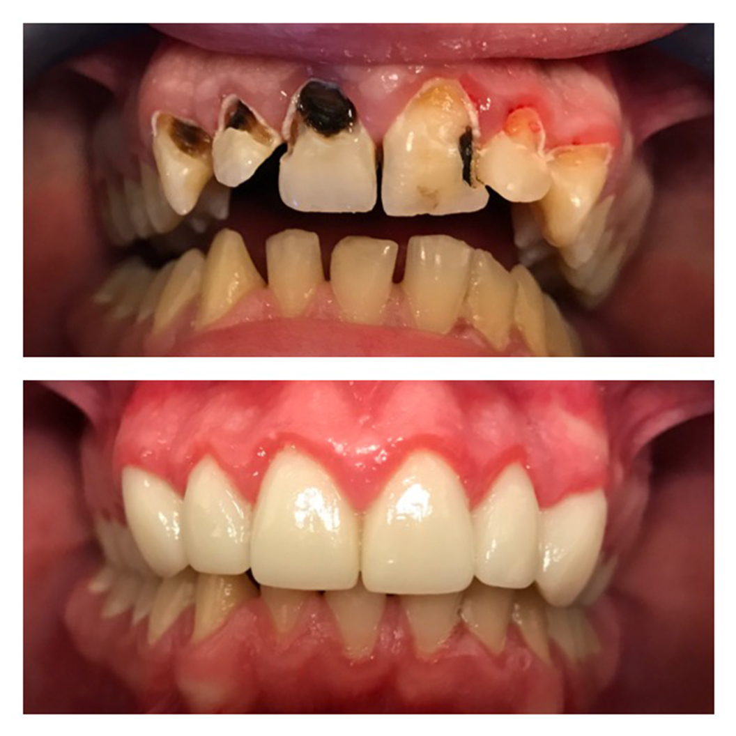 qdental