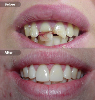 qdental