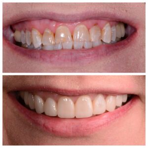 qdental