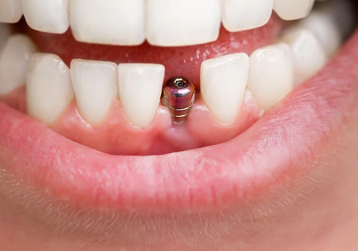qdental