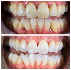 qdental