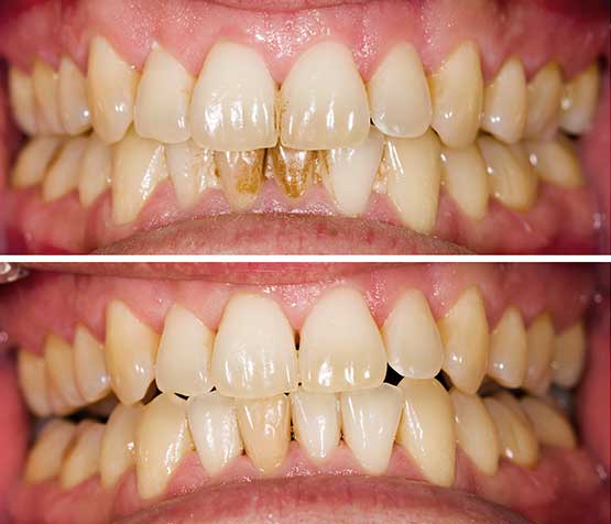 qdental