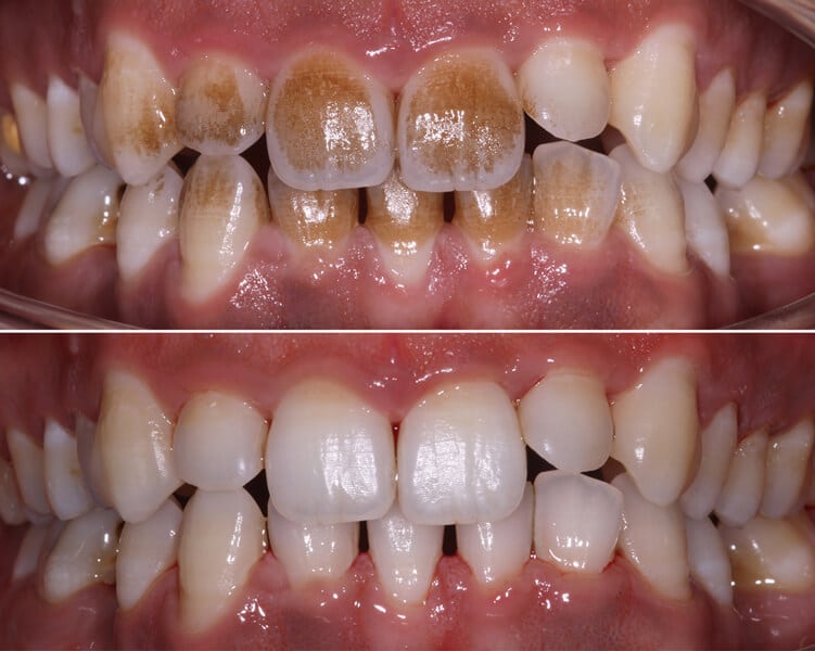 qdental
