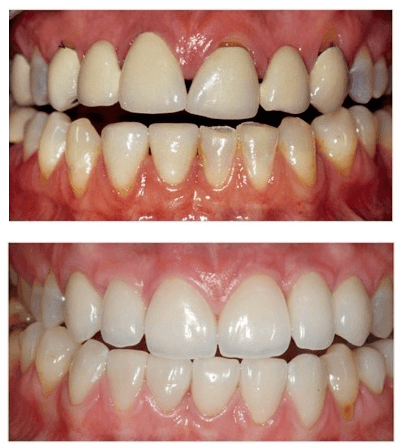 qdental