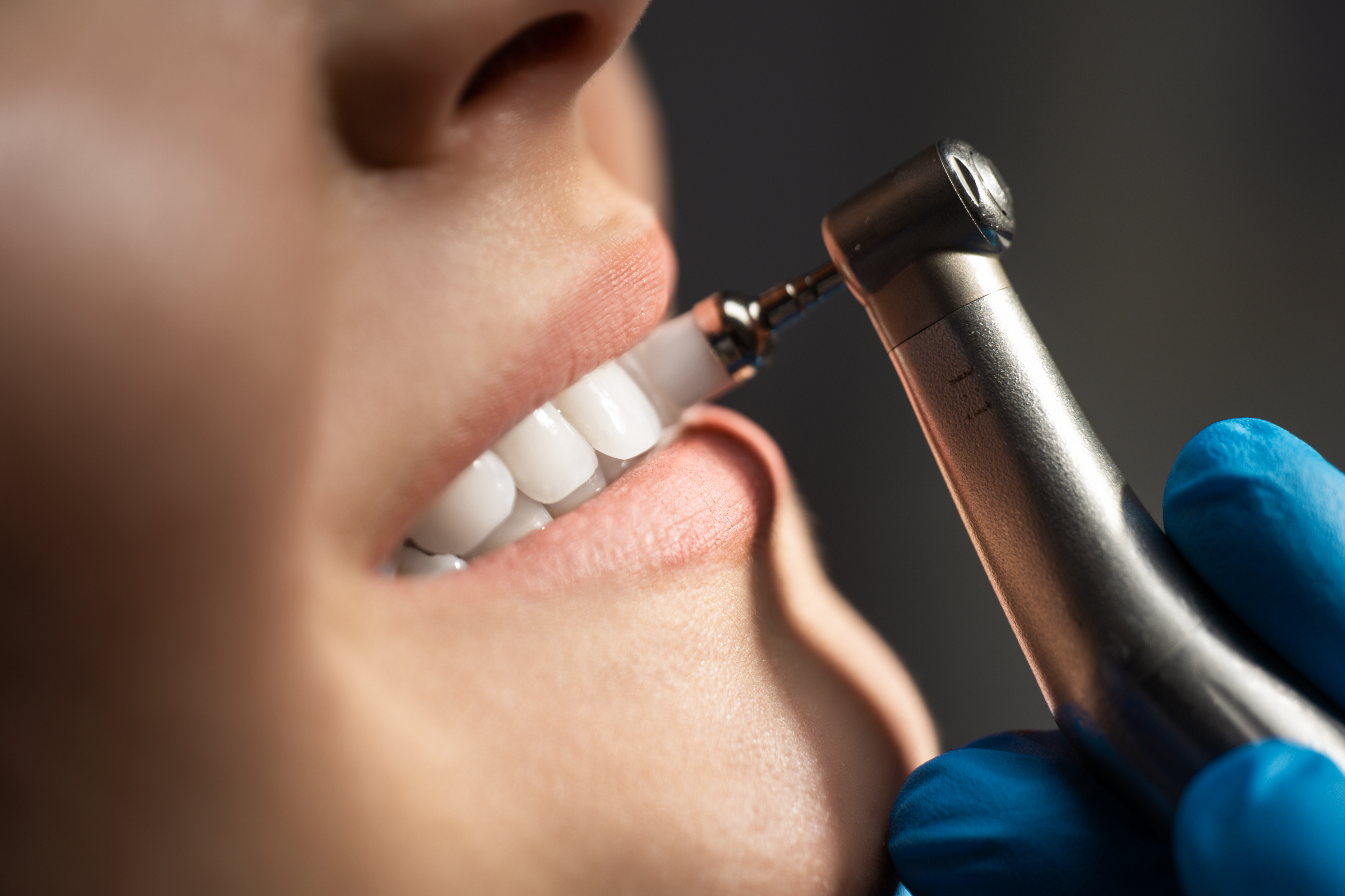 qdental
