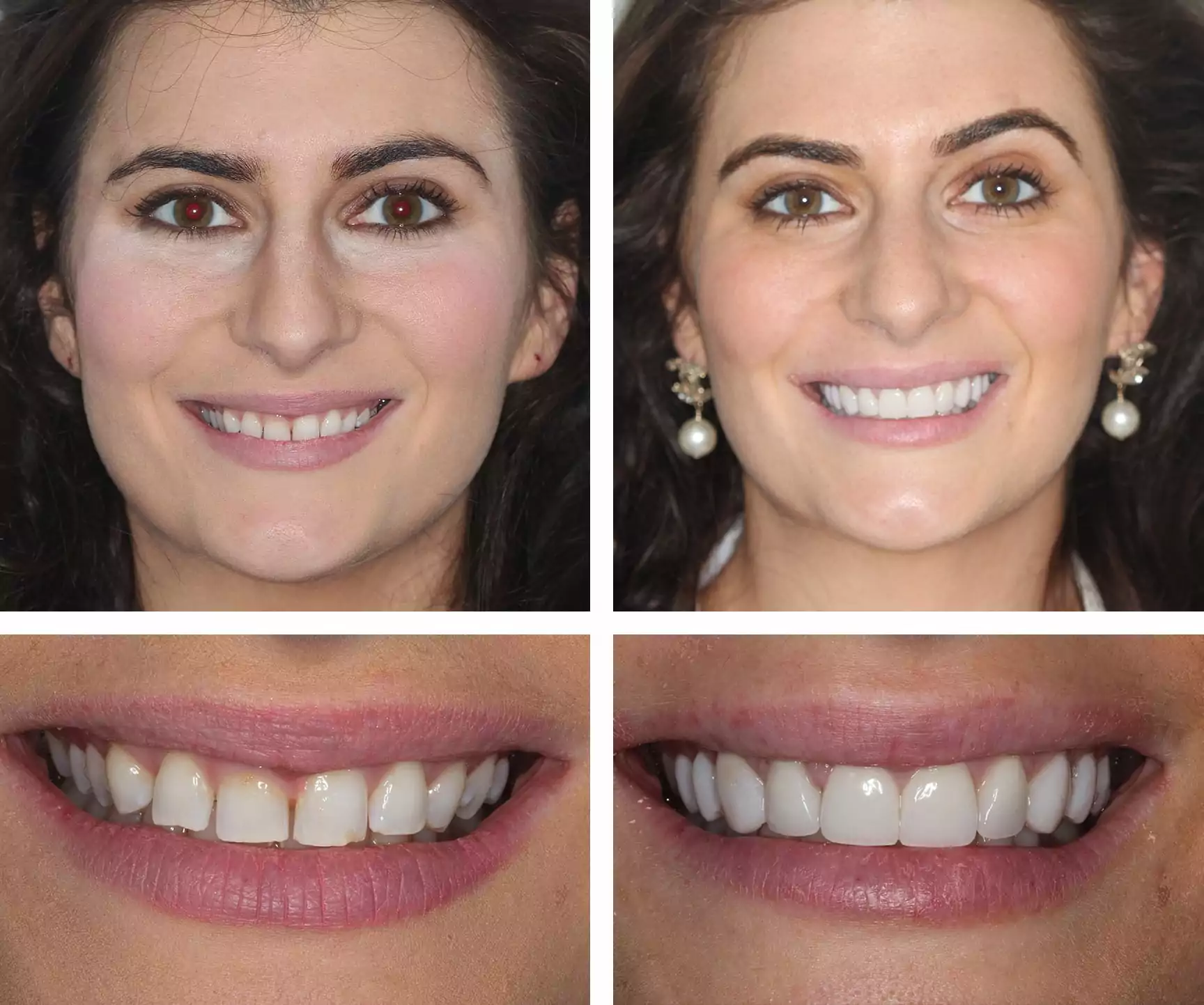 qdental