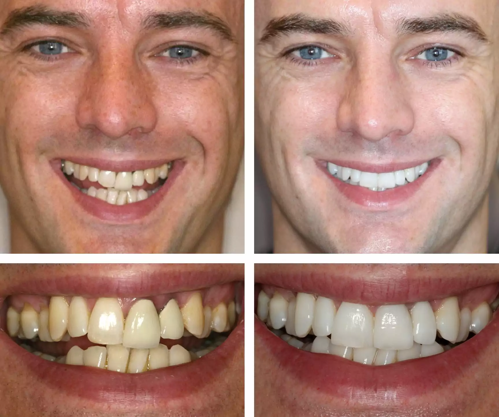 qdental