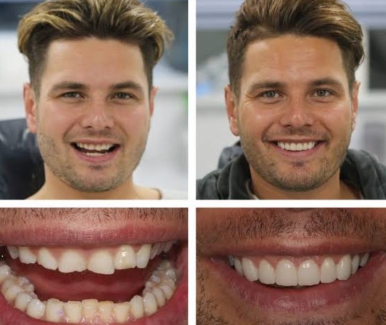 qdental