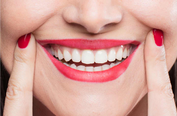 Smile Designing