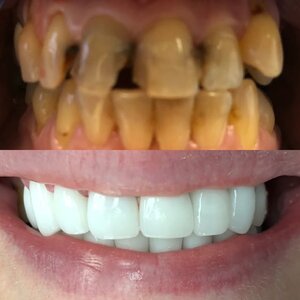 qdental