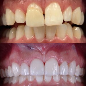 qdental