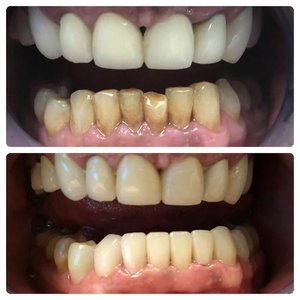 qdental