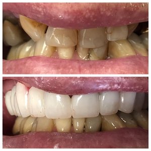 qdental