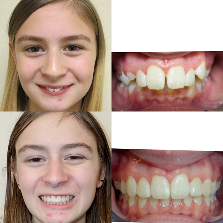 qdental