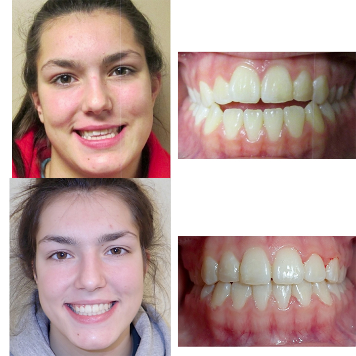 qdental