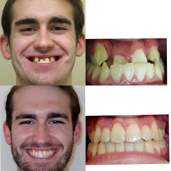 qdental